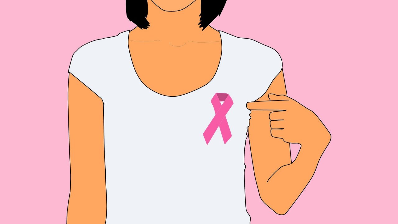 Ковид стопирао скрининг мамографије, самопрегледи кључни