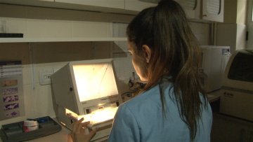 Сезона је свињокоља, трихинелоза прети