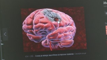Мождани удар се може спречити