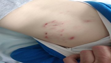 Белгијски овчари ујели петоро деце