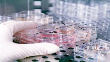 Четврти покушај вантелесне оплодње о трошку Града